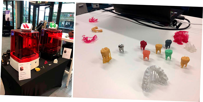 Las impresoras 3D SprintRay son ideales para los profesionales de la industria dental.