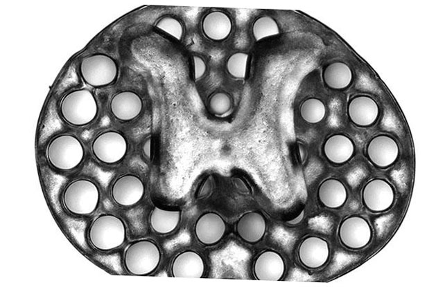 el implante de medula espinal promueve el crecimiento de las celulas nerviosas 5f6bdc8815108
