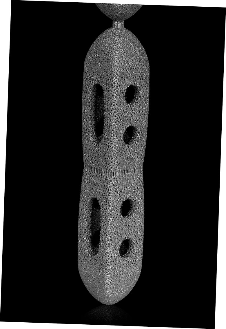 el motor betatype mejora la geometria interna del implante ortopedico 5f6bdc9a0f10d