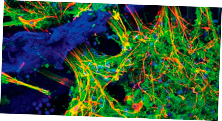 investigadores bioprint brain tissue creando una red neuronal funcional 5f6bde5bc861a