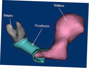 maryland researchers 3d print protesis de oido medio 5f6be0e09ccd2