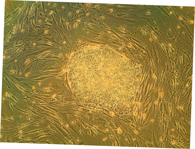 nano dimension registra patentes para estructuras bioartificiales 5f6be9f0f167c