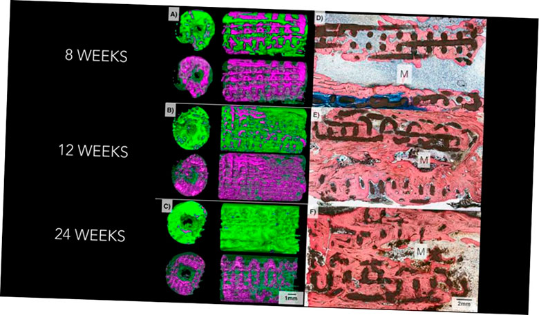 nyu researchers implantes oseos en crecimiento con impresion 3d 5f6be0d24f7af