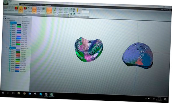 Preparación y alineación de un escaneo 3D con ScanCenter.