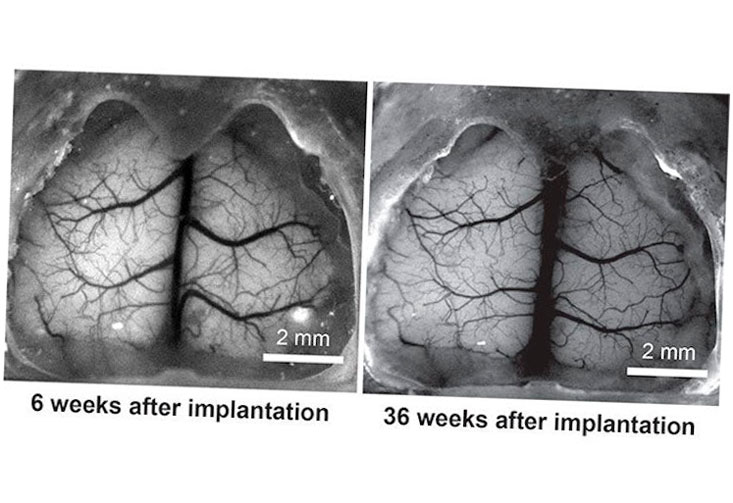 see shell craneos transparentes impresos en 3d que ayudan en la investigacion del cerebro 5f6bda9c1f663