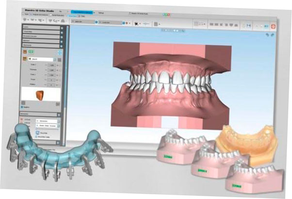 shining 3d colabora con age para acelerar la solucion dental 5f6be0d9ae2cd