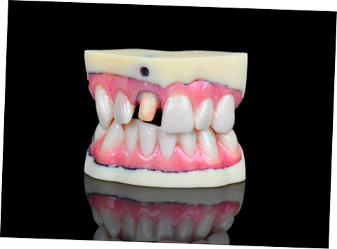 stratasys j720 imprime productos dentales a todo color 5f6bdba782234